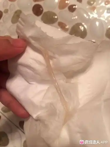 我17号检查卵泡才15×10啊   还没成熟   排卵试纸颜色很浅