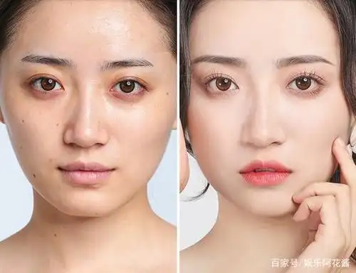 它被誉为"皮肤的软黄金",补水美白,还能去除暗沉痘印!