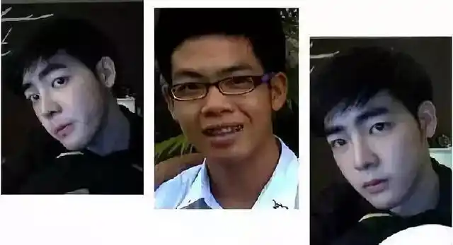 泰国小哥因长太丑花74万整容,成功从丑男变网红