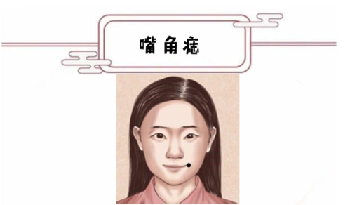 女人五颗"薄命"痣,不同痣相命不同!