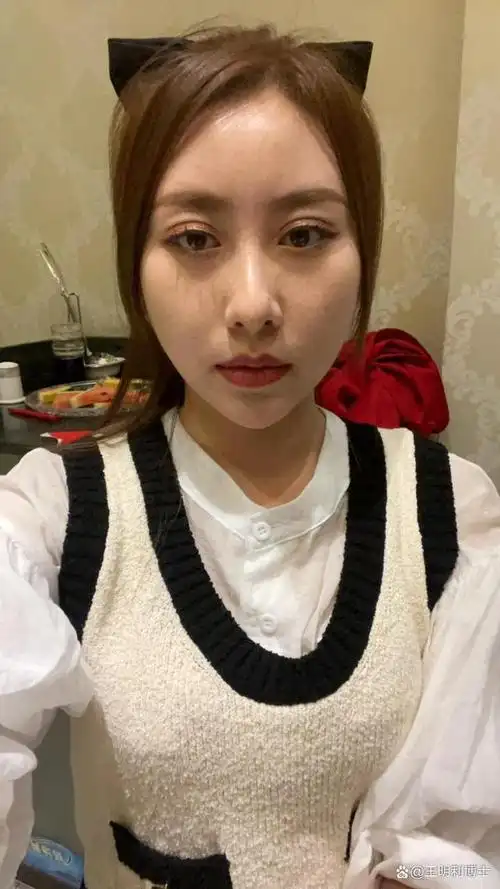 全脸脂肪填充术后究竟是什么感觉?最后一个真接受不了?