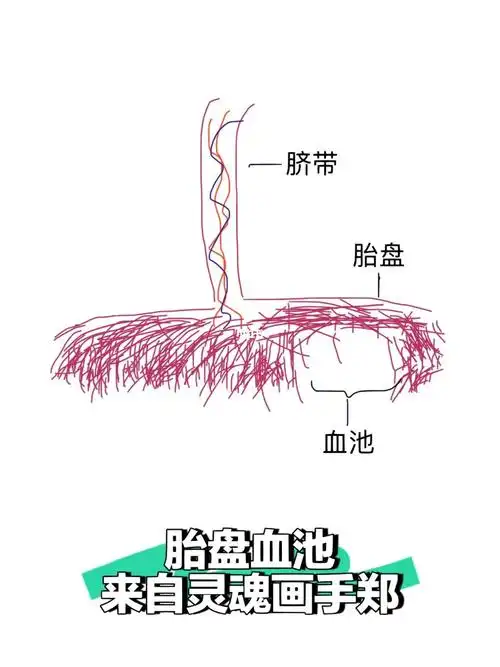 胎盘血池常见不是出血不用焦虑