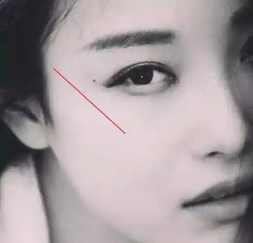 以颧骨和外眼角为外围的区域,都是泪痣的范围