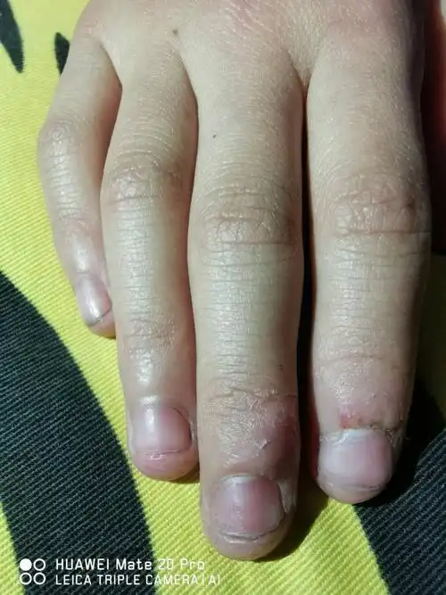 这孩子的手指头这是怎么回事?