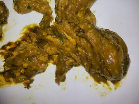 做完胃镜拉黑便正常不?