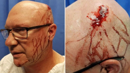 慎入 | 悉尼发生群斗 一名警员劝架却被用玻璃瓶爆头