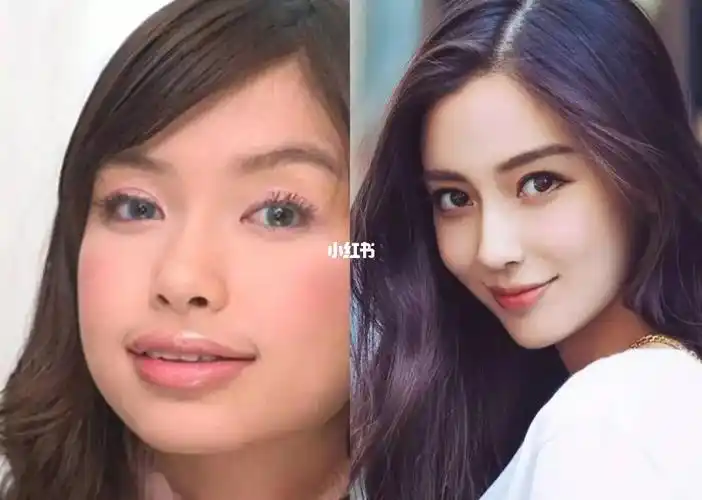 明星整牙前后对比图_整牙_脸型_整容_整牙经验_美妆_医美整形