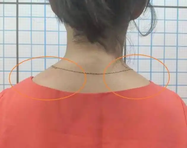 体态训练一女生如何减斜方肌