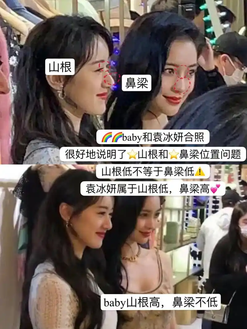 鼻基底凹陷or法令纹 常见的塌鼻子成因 1.山根低2.鼻梁低3.