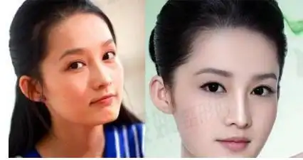 网友贴出李沁整容前后照片,是化妆还是整容实锤?