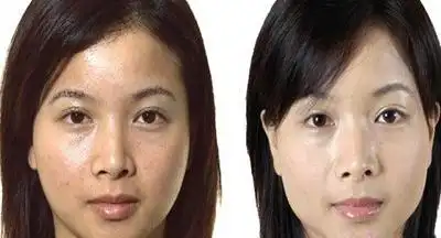 美白对比补血美白,白得有光彩!