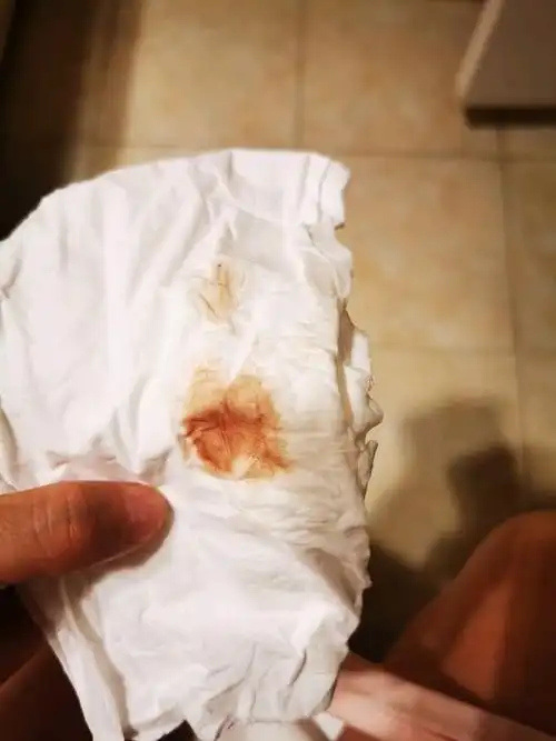 有没有怀孕两个月突然出血的,血量不多,第二天血变成咖啡色,这样会不