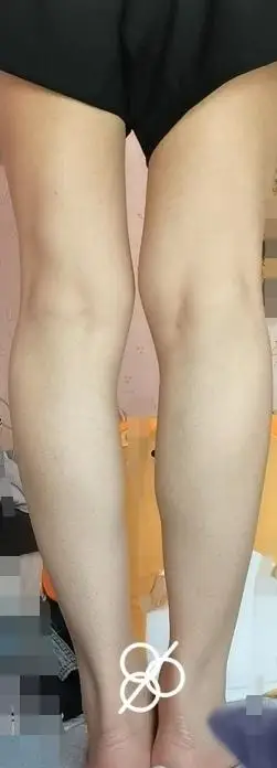 姐妹们这个腿型怎么办啊