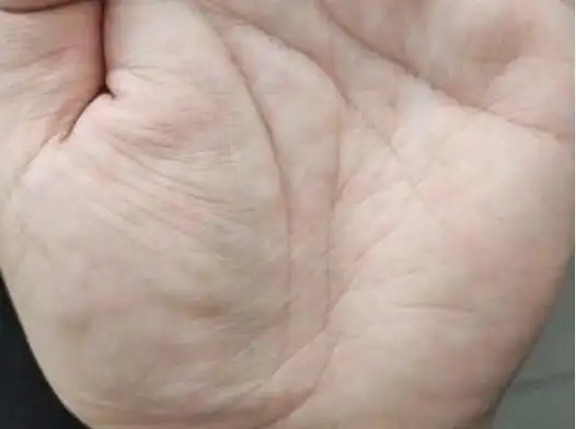【三,掌纹清晰】掌纹清晰度,乃先天赋予与后天塑造之结晶.