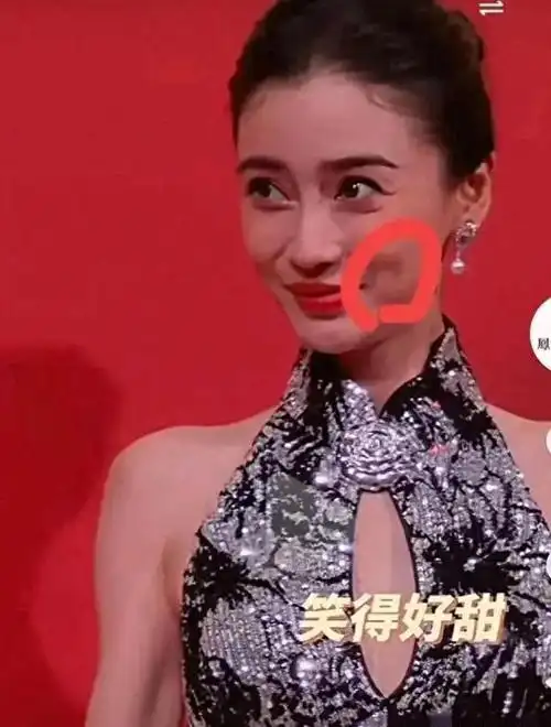 这"科技脸"终究垮了|整容|娱乐圈|时装周|女明星_网易订阅