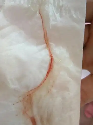 怀孕37周有白带有血