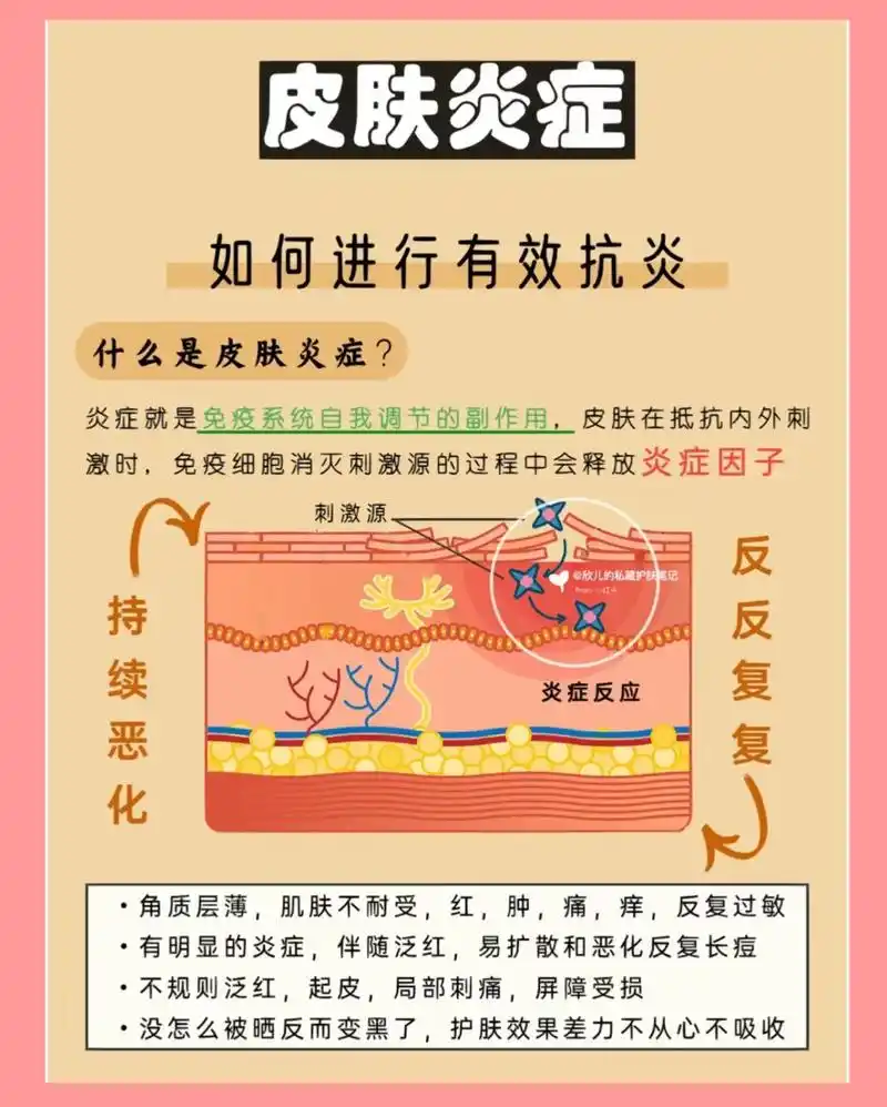 如何进行有效地抗炎9869♀15.