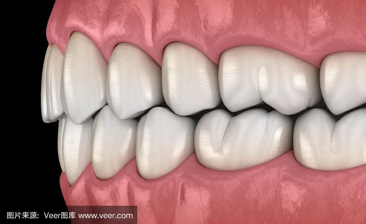 侧面图,正常咬合的健康人类牙齿.医学上准确的牙齿3d插图