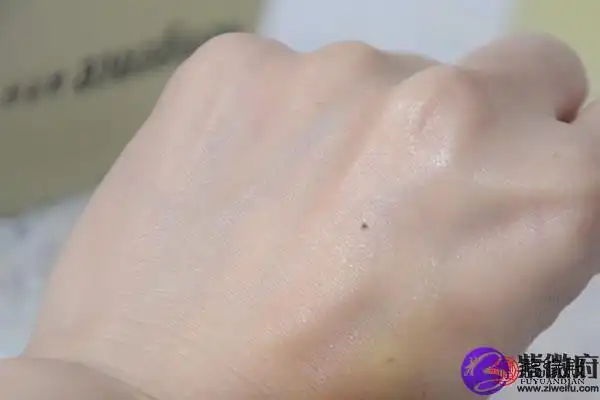 手背上有痣图解