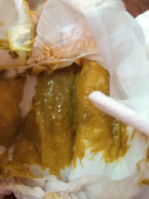 宝宝拉的屎变这样了怎么回事啊