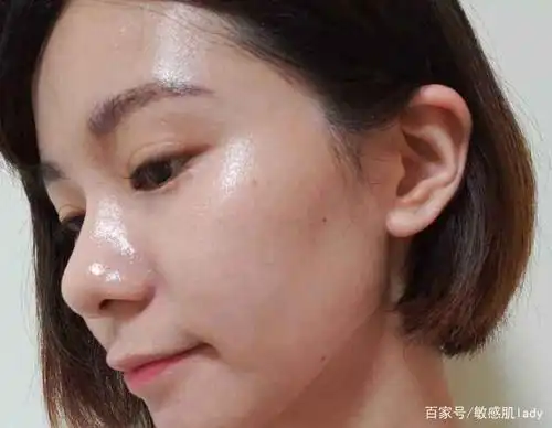 油性皮肤这样护理才对