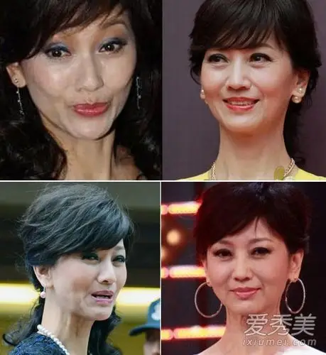 专题:整容失败的明星媒袢战沟