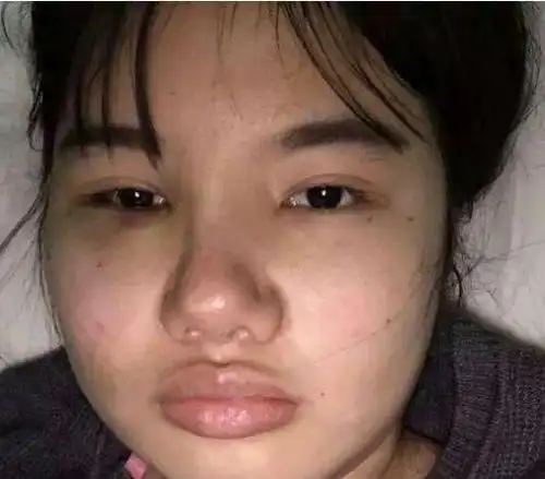 四位丑女花巨资整成杨幂, 赵丽颖, 热巴和baby, 唯独她亏大了!