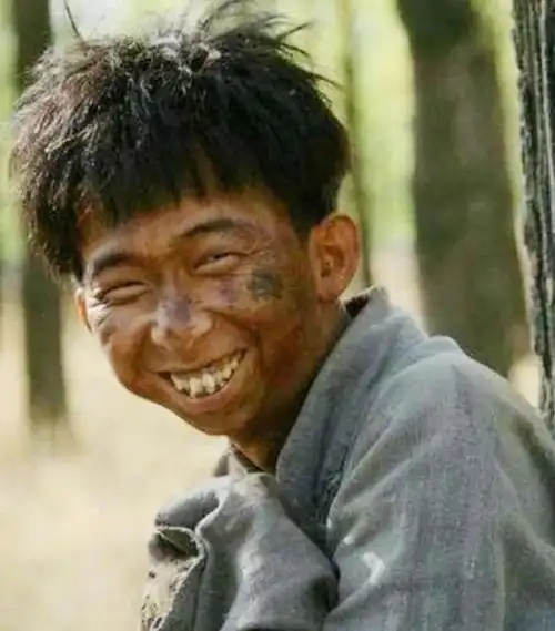 牙齿越来越往外凸,脸颊上肉也变少了.明显看出黑了,而且越来越瘦了.