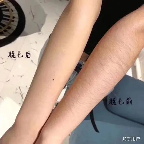 拔毛是否会让毛发变黑变粗