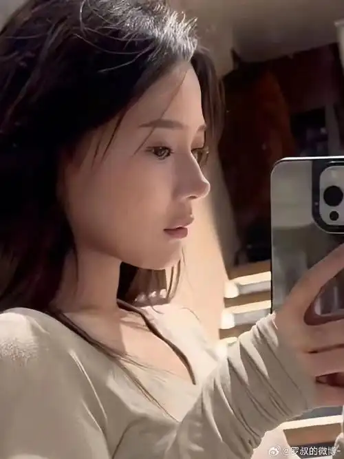 在西安做的鼻子 真的好自己的侧脸有人能懂这个91吗