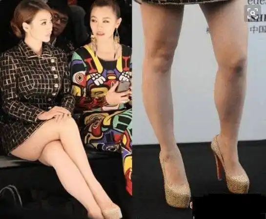 腿丑的女明星:柳岩全是肌肉,奶茶妹妹罗圈腿,阿娇腿粗有原因