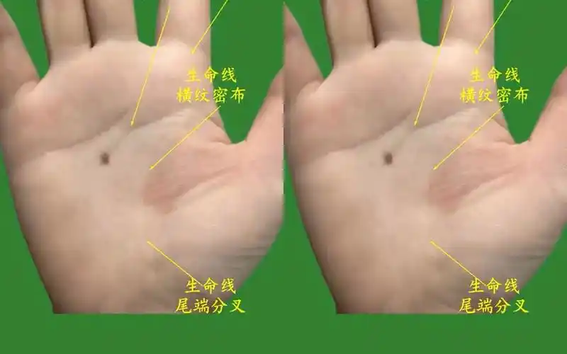 女人手相这有颗痣容易有头疾
