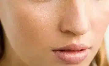 皮肤粗糙暗黄不解决基础问题只能做黄脸婆