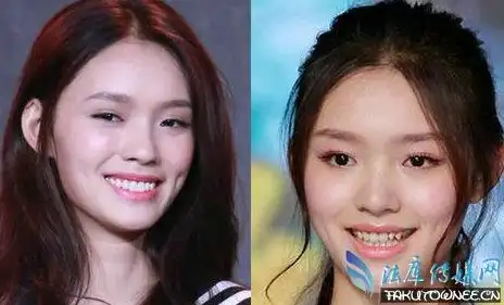 林允为什么整掉标志性的虎牙?林允表白吴亦凡是怎么回事?