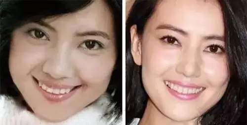 不动刀不打针高圆圆的0成本秒回春秘籍你要不要