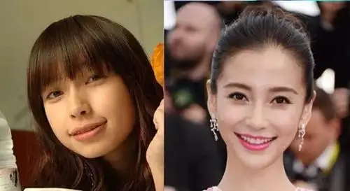 angelababy承认只动了【牙】