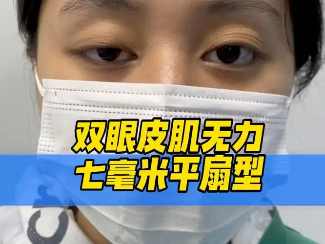 双眼皮肌无力七毫米平扇型
