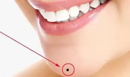 发大财的下巴痣 哪些痣可以发大财-善吉网