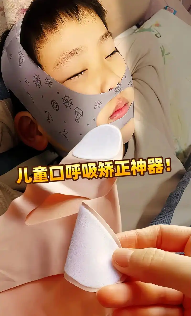 【儿童口呼吸矫正神器】告别腺样体面容!