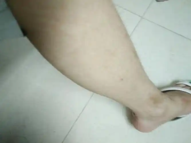 怎么把小腿肚瘦下去?(看图片)