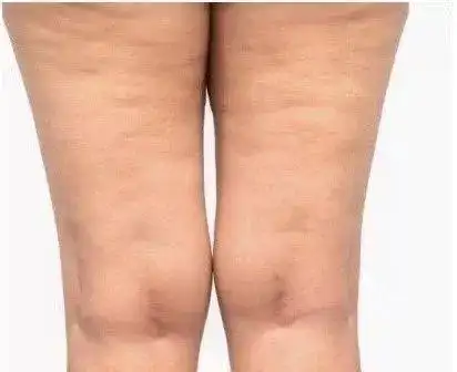 二字顶流美少女暴瘦20斤,竟被爆去韩国吸脂!