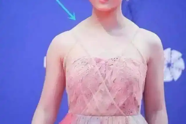 的特殊物质,一般3-6个月就会被人体代谢掉,只能解决斜方肌肥大的问题