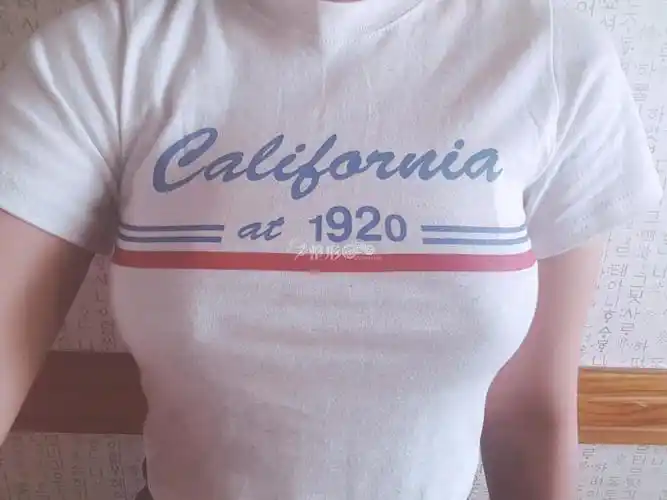 赛彬胸12天,"胸"感强烈_韩国整形社区_韩国整容问答_韩国整形经验交流