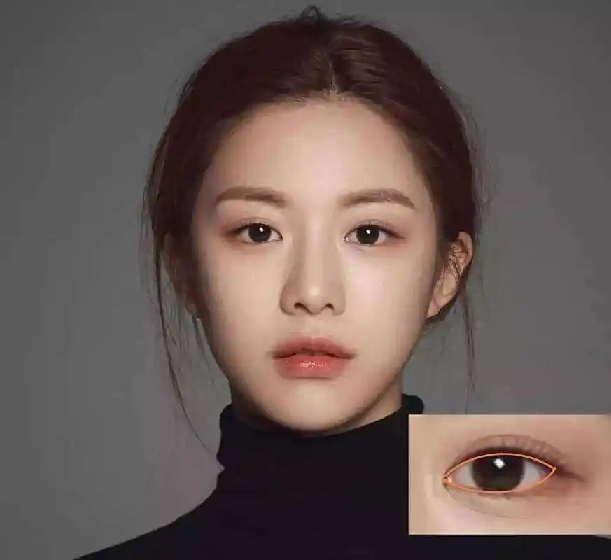 做了双眼皮之后很疼?能吃止疼药吗?