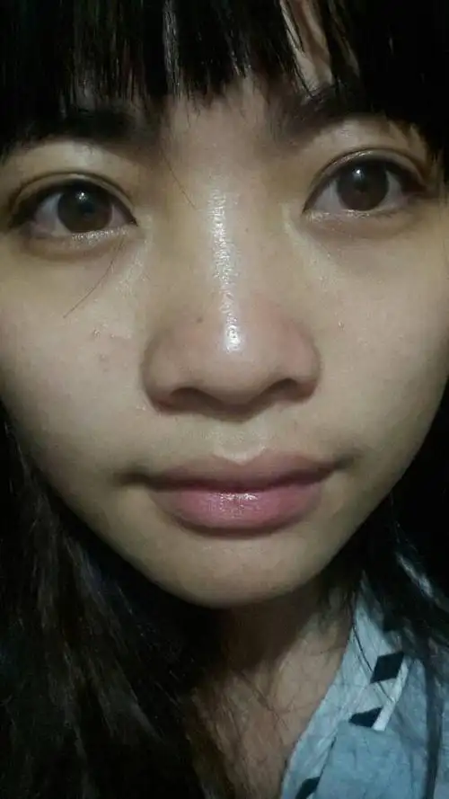 发现脸上毛孔比较明显 应该是属于油性皮肤吧 我是男生 21岁 应该用