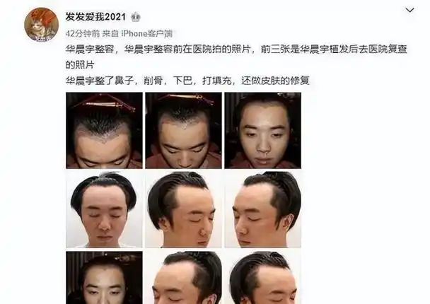 假发,假肩,假腹肌,除了性别"不造假",这些明星什么是真的?
