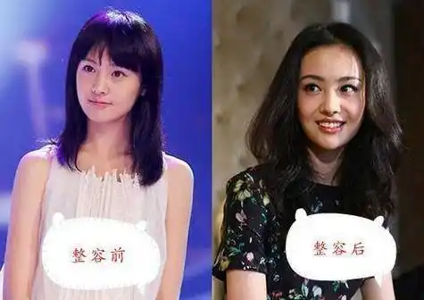 自己没整容过的明星,前后差距大的让网友们无法相信_杨幂_差别_李小璐