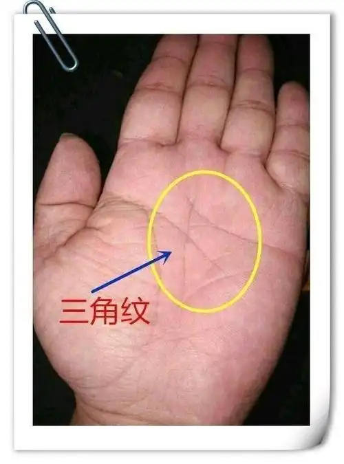 2022年感情线上方凶纹手相解析:金房子手相三角纹