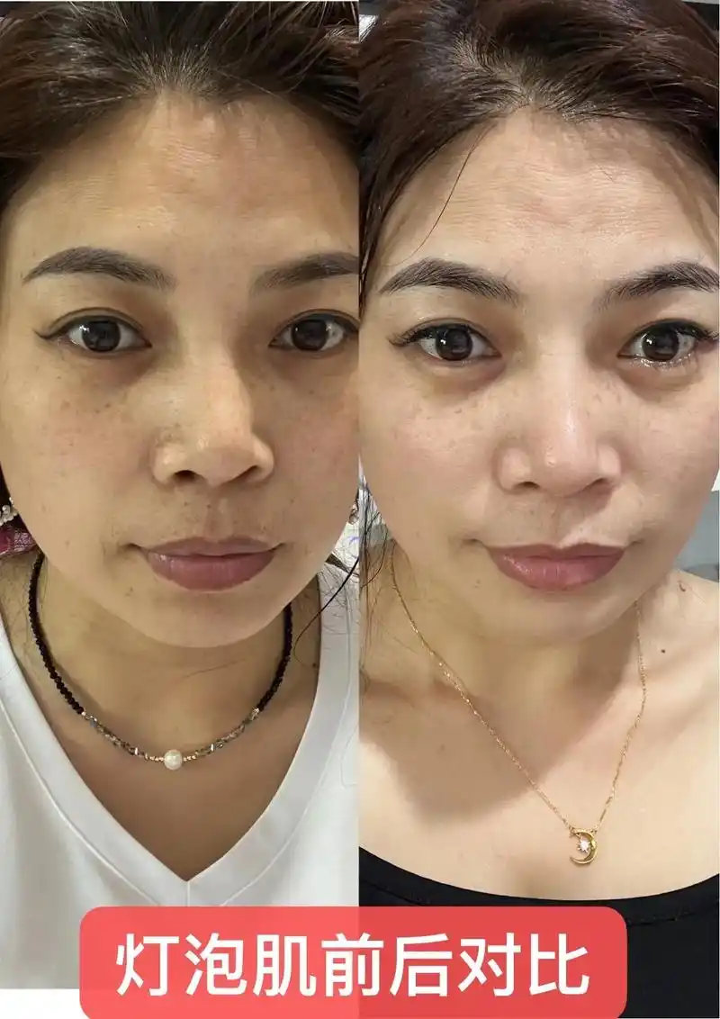 问题性皮肤管理 #前后对比 #不做黄脸婆 你想改善你的皮肤 - 抖音