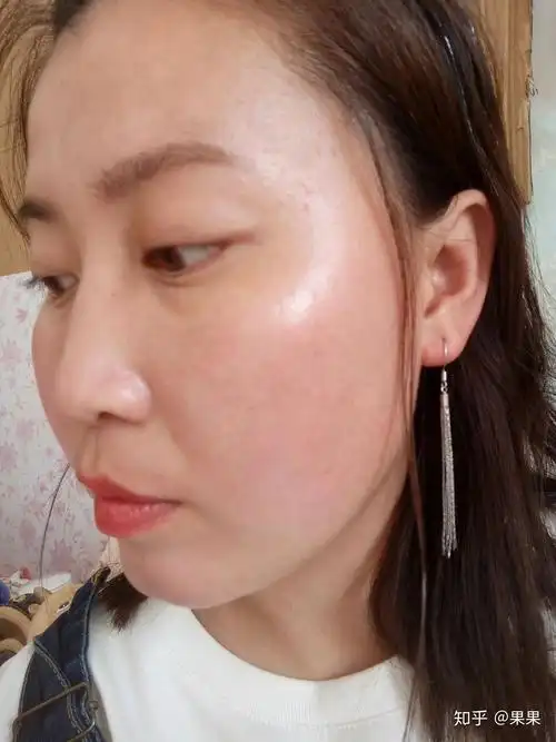 我是高敏肌肤,用洗面奶特别容易过敏,有没有什么好的敏感肌用的洗面奶